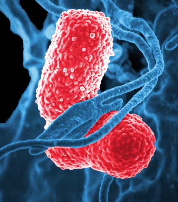장아찌·김치 같은 발효음식의 건강학